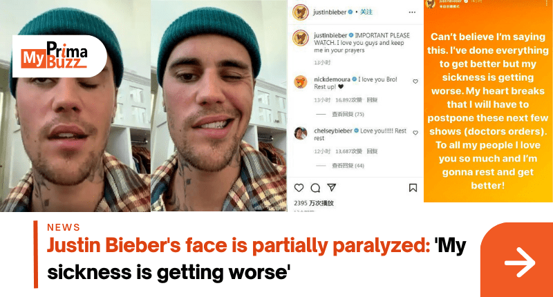 Justin Bieber